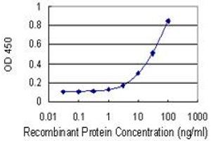 Detection limit for recombinant GST tagged BCAT1 is 1 ng/ml as a capture antibody. (BCAT1 antibody  (AA 1-320))