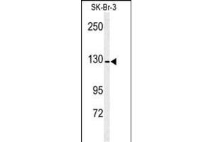 Western blot analysis of ANPEP antibody (Center) (ABIN391875 and ABIN2841695) in SK-Br-3 cell line lysates (35 μg/lane). (CD13 antibody  (AA 615-641))