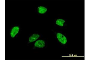 Immunofluorescence of purified MaxPab antibody to A1CF on HeLa cell. (A1CF antibody  (AA 1-594))