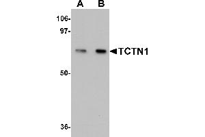 Western Blotting (WB) image for anti-Tectonic Family Member 1 (TCTN1) (N-Term) antibody (ABIN1031607) (TCTN1 antibody  (N-Term))