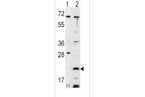 Western blot analysis of FXN using rabbit polyclonal FXN Antibody using 293 cell lysates (2 ug/lane) either nontransfected (Lane 1) or transiently transfected with the FXN gene (Lane 2). (Frataxin antibody  (C-Term))