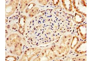 IHC image of ABIN7166424 diluted at 1:200 and staining in paraffin-embedded human kidney tissue performed on a Leica BondTM system. (LOX antibody  (AA 174-417))