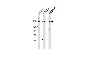 Western Blot at 1:2000 dilution Lane 1: MCF-7 whole cell lysate Lane 2: MOLT-4 whole cell lysate Lane 3: SH-SY5Y whole cell lysate Lysates/proteins at 20 ug per lane.