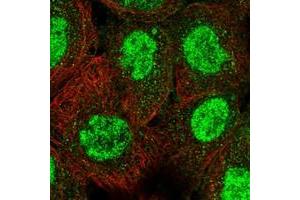 Immunofluorescent staining of human cell line A-431 with TRIM66 polyclonal antibody  at 1-4 ug/mL dilution shows positivity in nucleus but not nucleoli. (TRIM66 antibody)