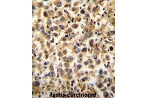 CCDC19 Antibody (N-term) immunohistochemistry analysis in formalin fixed and paraffin embedded human testis carcinoma followed by peroxidase conjugation of the secondary antibody and DAB staining. (CCDC19 antibody  (N-Term))