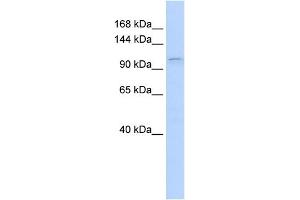 WB Suggested Anti-PGR Antibody Titration:  0. (Progesterone Receptor antibody  (N-Term))