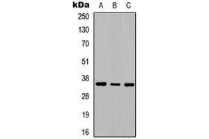 Western blot analysis of Adenosine A2b Receptor expression in SHSY5Y (A), NIH3T3 (B), rat kidney (C) whole cell lysates. (Adenosine A2b Receptor antibody  (C-Term))