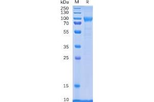 Human CD114 Protein, His Tag on SDS-PAGE under reducing condition. (CSF3R Protein (His tag))