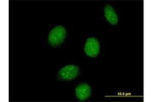 Immunofluorescence of purified MaxPab antibody to SSBP2 on HeLa cell. (SSBP2 antibody  (AA 1-361))