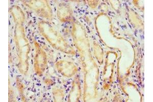 Immunohistochemistry of paraffin-embedded human kidney tissue using ABIN7150217 at dilution of 1:100 (ALKBH2 antibody  (AA 1-261))
