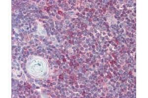 Image no. 1 for anti-RAN, Member RAS Oncogene Family (RAN) (AA 1-179) antibody (ABIN467626) (RAN antibody  (AA 1-179))
