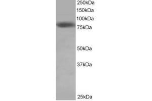 Image no. 1 for anti-NDC80 Kinetochore Complex Component Homolog (NDC80) (C-Term) antibody (ABIN374264) (NDC80 antibody  (C-Term))