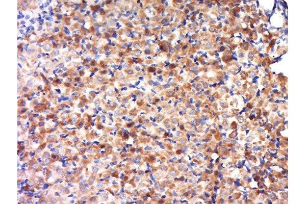OVCA2 antibody  (AA 11-100)