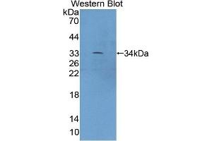 Detection of Recombinant XYLT2, Mouse using Polyclonal Antibody to Xylosyltransferase II (XYLT2) (XYLT2 antibody  (AA 596-865))