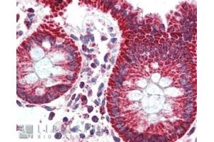 Immunohistochemistry (IHC) image for anti-Peripheral-Type Benzodiazepine Receptor (TSPO) (C-Term) antibody (ABIN185697)