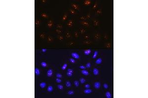 Immunofluorescence analysis of U-2 OS cells using Fibrillarin/U3 RNP Rabbit mAb (ABIN7267175) at dilution of 1:100 (40x lens). (Fibrillarin antibody)