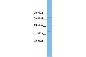 WB Suggested Anti-GRAP Antibody Titration: 0. (GRAP antibody  (Middle Region))