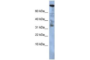 Western Blotting (WB) image for anti-Zinc Finger Protein 251 (ZNF251) antibody (ABIN2458235) (ZNF251 antibody)