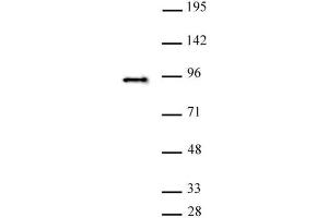 SATB2 antibody (pAb) tested by Western blot. (SATB2 antibody  (C-Term))