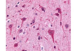 Anti-GPR75 antibody IHC of human brain, neurons and glia. (GPR75 antibody  (C-Term))