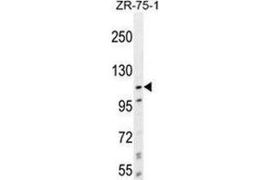 Western blot analysis in ZR-75-1 cell line lysates (35ug/lane) using PCDHA8 Antibody .