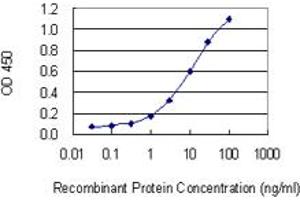 Detection limit for recombinant GST tagged CNR2 is 0. (CNR2 antibody  (AA 302-360))