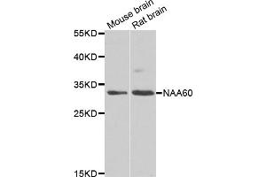 Western blot analysis of extracts of various cell lines, using NAA60 antibody (ABIN5975517) at 1/1000 dilution. (NAT15 antibody)