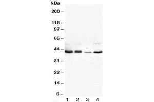 Western blot testing of VEGFD antibody and Lane 1:  SW620;  2: COLO320;  3: 6T-CEM;  4: HT1080 cell lysate