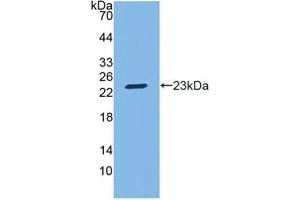 Detection of Recombinant SGPL1, Mouse using Polyclonal Antibody to Sphingosine 1 Phosphate Lyase 1 (SGPL1) (SGPL1 antibody  (AA 382-568))