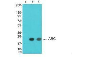 Western blot analysis of extracts from HeLa cells and A549 cells using ARC antibody. (ARC antibody)