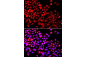 Immunofluorescence analysis of A549 cells using CALCOCO1 antibody (ABIN5975736).