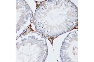Immunohistochemistry of paraffin-embedded mouse testis using PGRMC1 antibody (ABIN5973273) at dilution of 1/100 (20x lens). (PGRMC1 antibody)