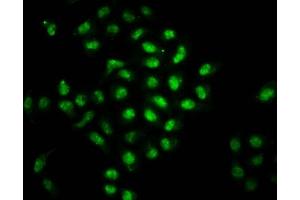Immunofluorescence staining of Hela cells with ABIN7145662 at 1:66, counter-stained with DAPI.