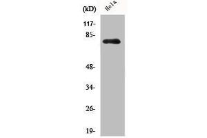 Western Blot analysis of HELA cells using Phospho-Btk (Y551) Polyclonal Antibody (BTK antibody  (pTyr551))
