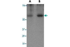 Western blot analysis of CLU in human brain tissue lysate with CLU polyclonal antibody  at (A) 0.