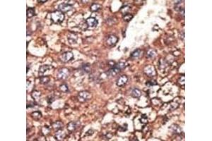 Immunohistochemistry (IHC) image for anti-Leptin Receptor (LEPR) (AA 23-52) antibody (ABIN3031603)
