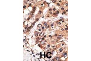 Immunohistochemistry (IHC) image for anti-Protein AF-9 (MLLT3) antibody (ABIN2971008) (AF9 antibody)