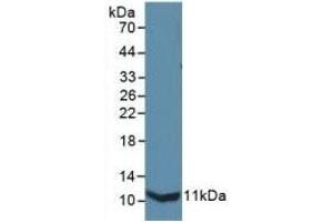 Detection of Recombinant IL13Ra2, Mouse using Polyclonal Antibody to Interleukin 13 Receptor Alpha 2 (IL13Ra2) (IL13RA2 antibody  (AA 228-338))
