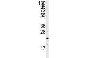Western Blotting (WB) image for anti-GTPase NRas (NRAS) (AA 72-101) antibody (ABIN3031130)