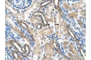 PSG1 antibody was used for immunohistochemistry at a concentration of 4-8 ug/ml to stain Epithelial cells of renal tubule (arrows) in Human Kidney.