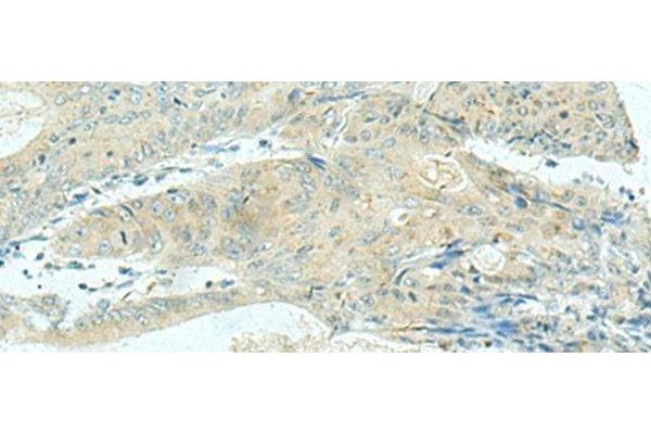 KIF21B antibody