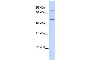 WB Suggested Anti-ALS2CR12 Antibody Titration: 0. (ALS2CR12 antibody  (N-Term))