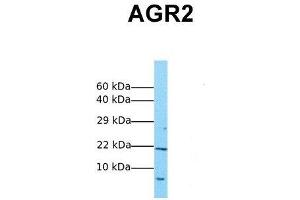 Host:  Rabbit  Target Name:  AGR2  Sample Tissue:  Human MCF7  Antibody Dilution:  1. (AGR2 antibody  (Middle Region))