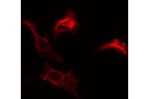 ABIN6274782 staining COLO205 cells by IF/ICC.