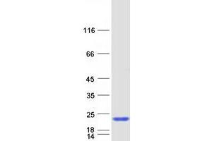 Validation with Western Blot (SAP18 Protein (Myc-DYKDDDDK Tag))