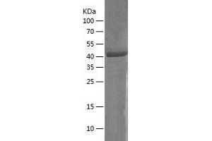 CD177 Protein (AA 22-408) (His tag)