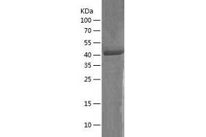 Western Blotting (WB) image for CD177 Molecule (CD177) (AA 22-408) protein (His tag) (ABIN7122193) (CD177 Protein (AA 22-408) (His tag))