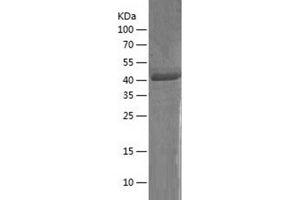 CD177 Protein (AA 22-408) (His tag)