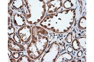 Immunohistochemical staining of paraffin-embedded liver tissue using anti-IFIT1 mouse monoclonal antibody.