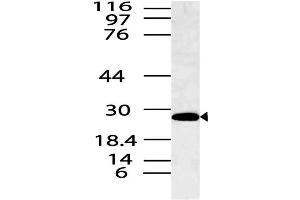 Image no. 1 for anti-Spi-B Transcription Factor (Spi-1/PU.1 Related) (SPIB) antibody (ABIN5027786) (SPIB antibody)